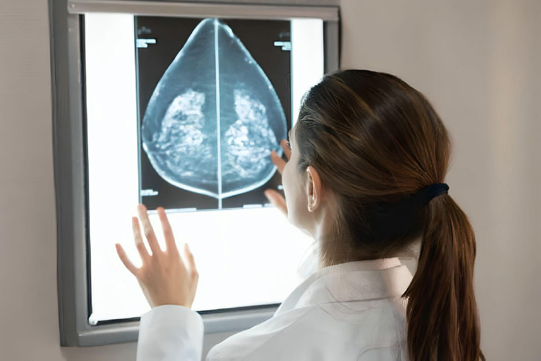 Bahraini women booking mammograms at a Manama hospital